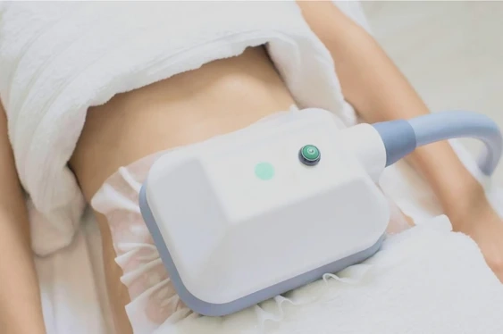 Freeze Fat Away: Non-Invasive Fat Reduction in Birmingham