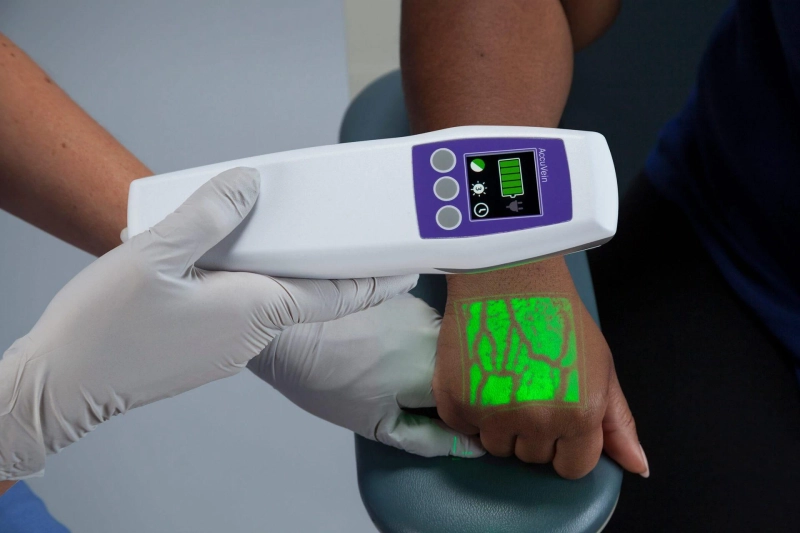 Market Dynamics of Vein Finder Devices: Current Scenario