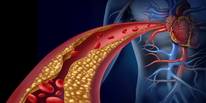 Does high cholesterol cause heart problems?