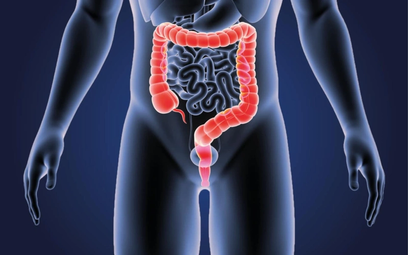 Several Cancer Drugs Are Used To Treat Colon and Rectal Cancer