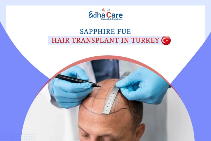 Sapphire FUE Hair Transplant in Turkey: Precision & Natural Hairlines