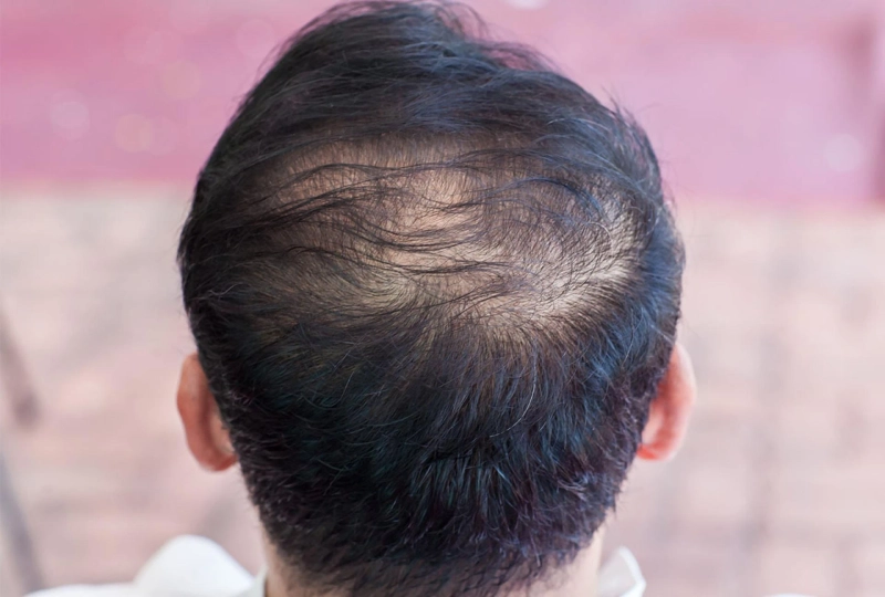 Breaking Free from Bad Hair Habits: How Professionals Help Correct Styling Mistakes