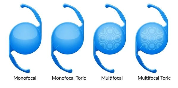 Eyhance IOL Lens in India: How It Improves Intermediate Vision