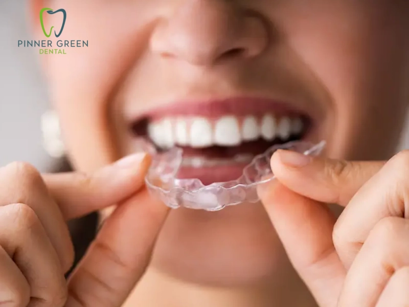 Get a Brighter, Whiter Smile with Professional Teeth Whitening in Pinner