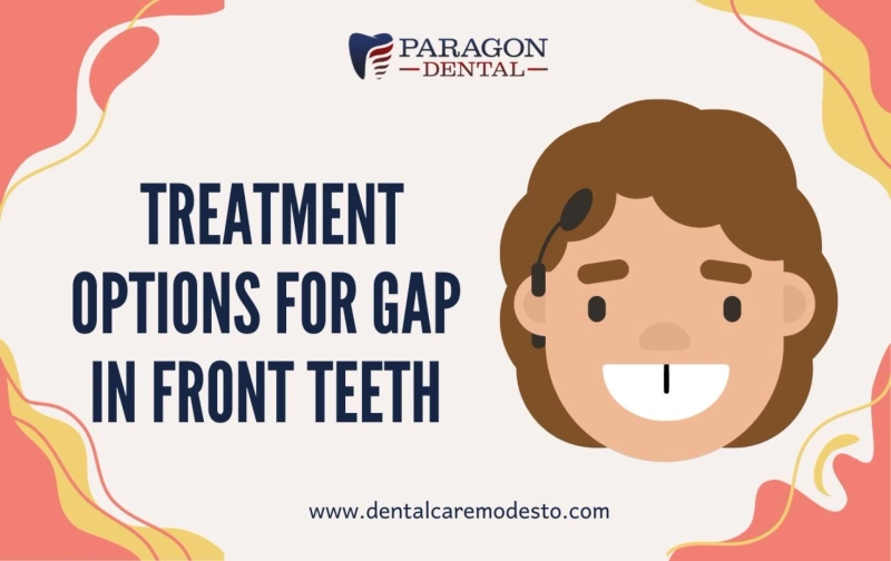 Treatment Options for Gap in Front Teeth