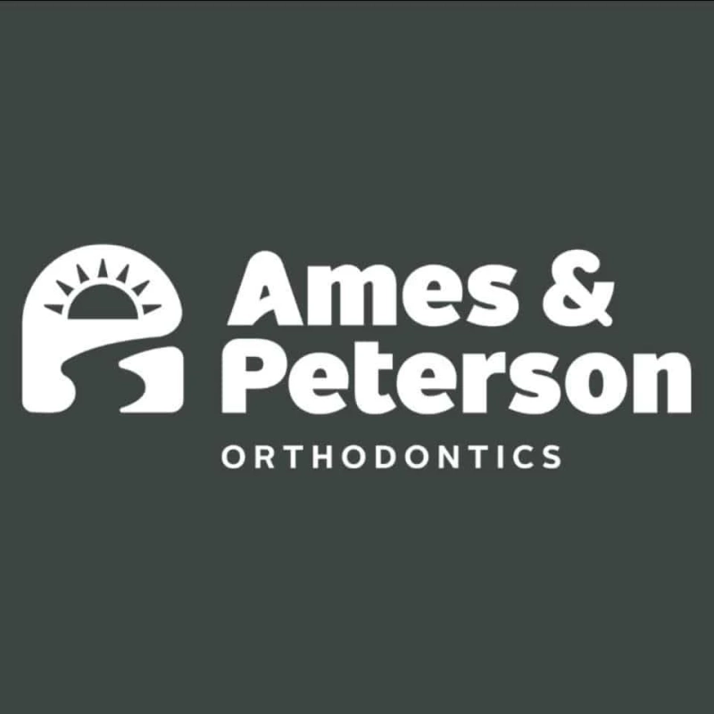 Important Facts About Invisalign Aligner That You Should Know