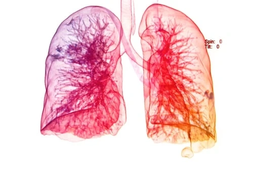 What are various respiratory distress syndrome treatment available in market today?