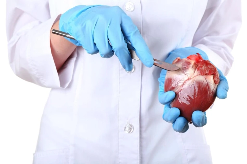 Special Considerations and Success Stories: Heart Transplants in Pediatric Patients