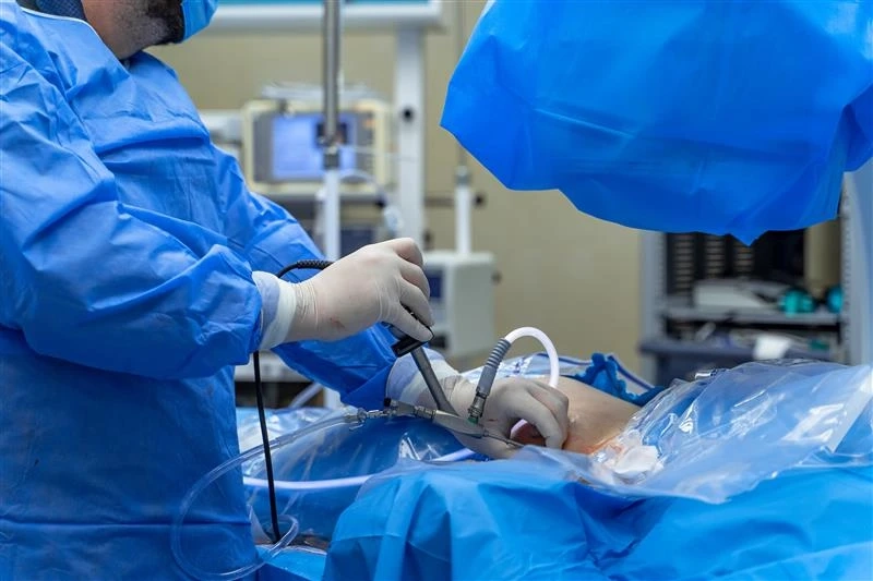 Top Questions to Ask When Choosing a Laparoscopy Specialist