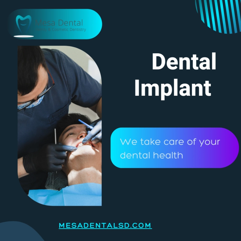 Dental Implants That Look, Feel, and Function Like Natural Teeth