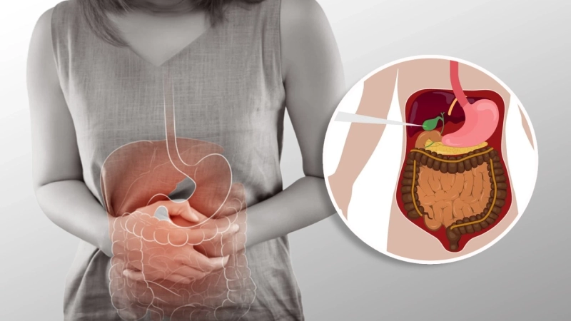 Where to Get Safe and Affordable Gallbladder Surgery in East Delhi?
