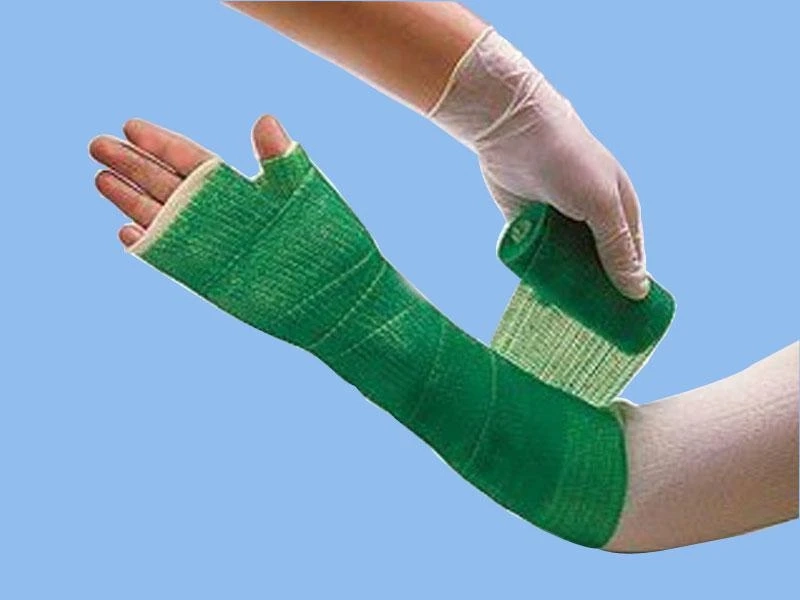 Both Orthopedic splints and casts straps provide the wearer with the opportunity to improve strength