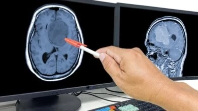Cracking the Code: Market Entry Strategy for Brain Cancer Therapies | DLI