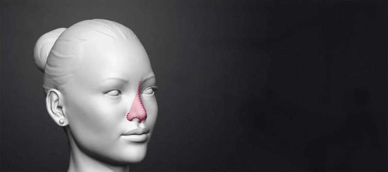 Renowned Surgeon who perform Best Rhinoplasty in India: Meet Dr. Parag Telang
