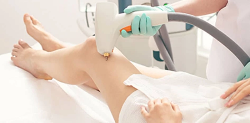 What Conditions Do Vascular Surgeons Treat?
