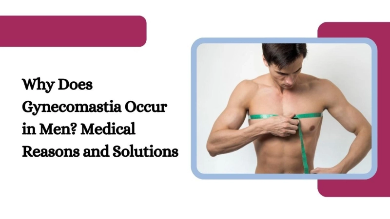 Why Does Gynecomastia Occur in Men? Medical Reasons and Solutions