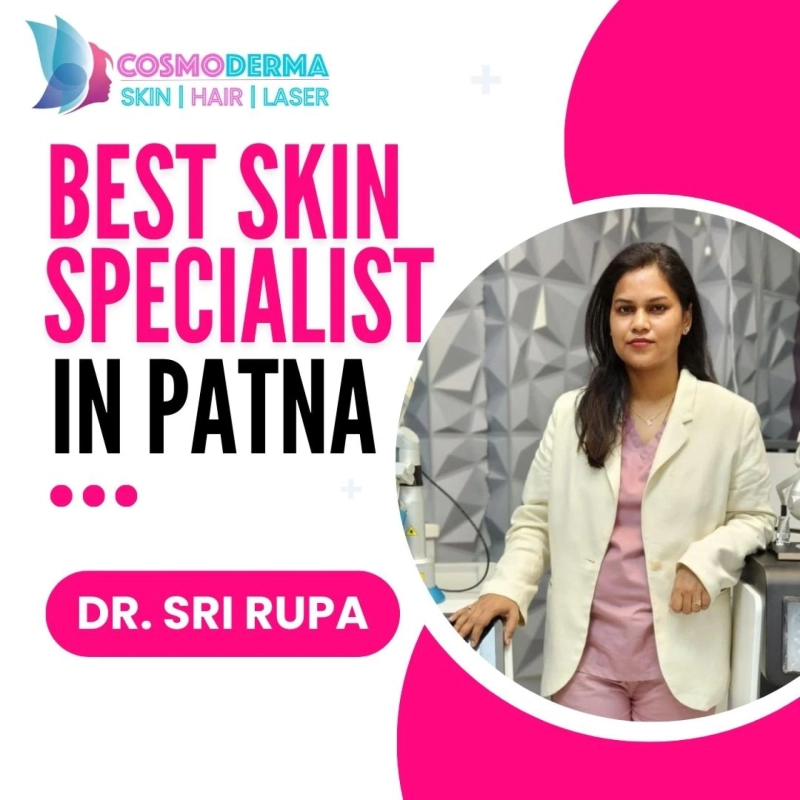 Get Flawless Skin with Dr. Sri Rupa - Best Skin Specialist in Patna