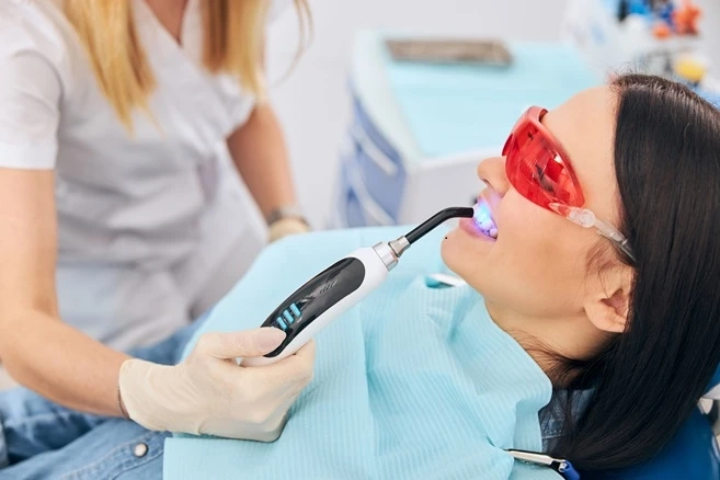 Step-by-Step Guide to Dental Cleaning