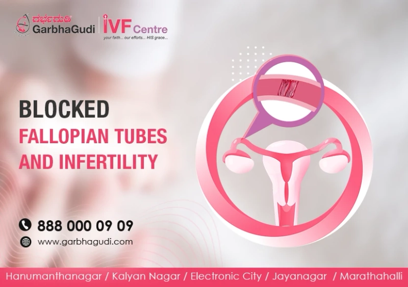 “IVF and blocked fallopian tubes. (Blocked Tubes? You can still Celebrate Your Baby) “