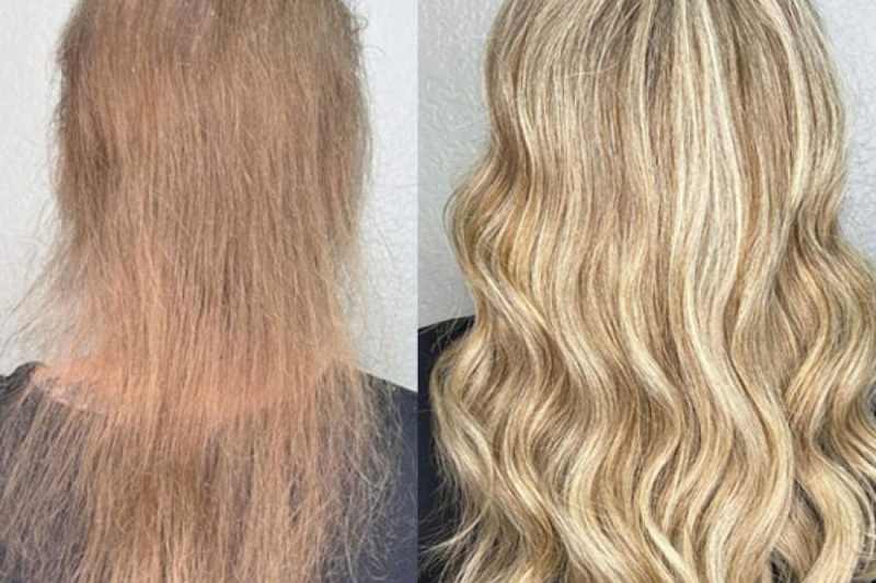 Benefits Of Invisible Bead Extensions