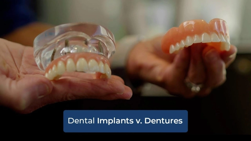Dental Implants vs. Dentures: Which Is Right for You?