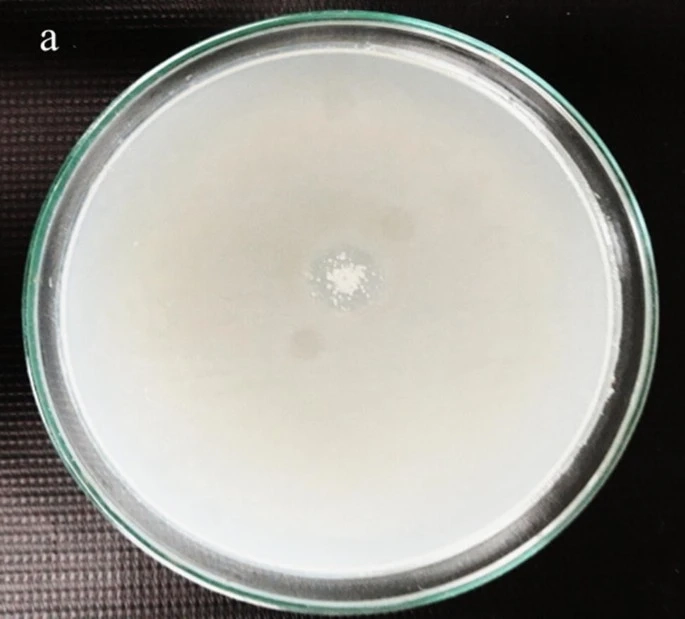 Chitosanase Market Comprehensive Study Explores Huge Growth With Demand By Forecast 2030.