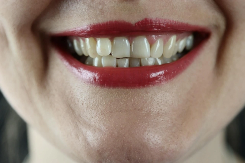 6 General Tips For Keeping Your Teeth Healthy And White