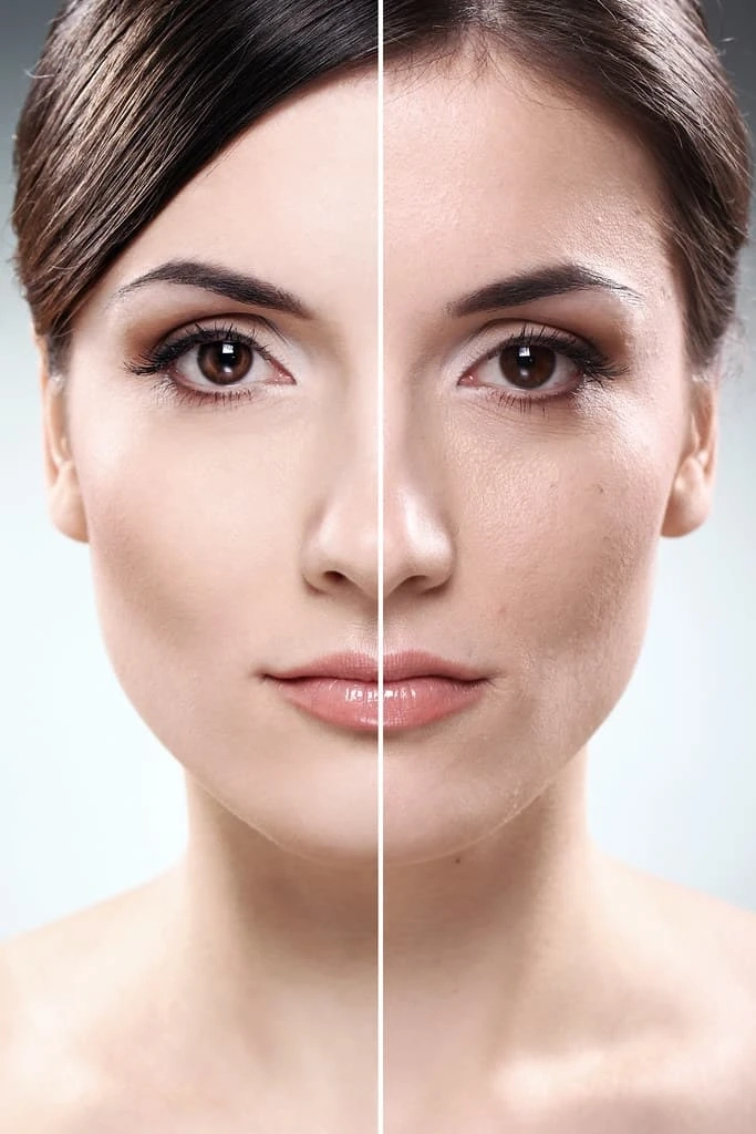 Skin Unification Treatment in Dubai: The Path to Radiant Beauty