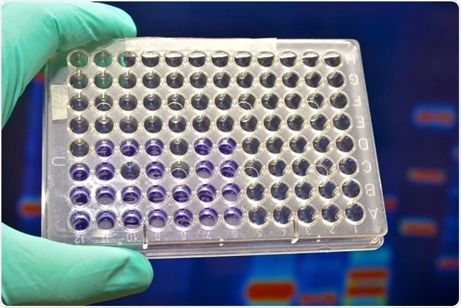Nucleic Acid Labelling Market Size, Demand, Competitive Analysis, Regional Growth and Forecast 2026