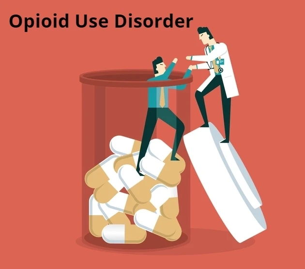 Opioid Use Disorder Market Size and Growth Forecast : Top Manufacturers,Future Developments,Regional