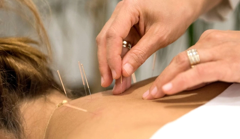 The Benefits of Physiotherapy for Movement and Strength