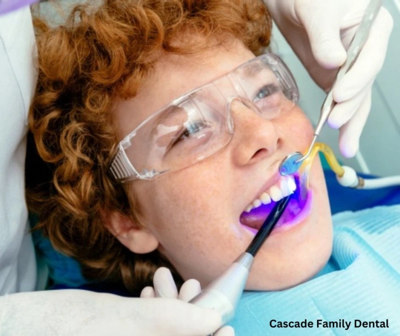 Premium Composite Resin Bonding at Cascade Family Dental