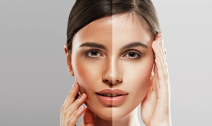 Ethical Considerations in Skin Whitening: Balancing Beauty and Cultural Sensitivity