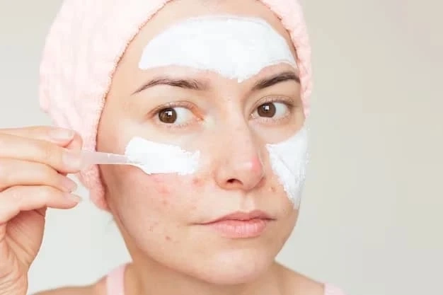 How to Use Acne Marks Removal Cream Effectively