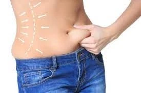 Enhance Your Contours: Liposuction in Abu Dhabi