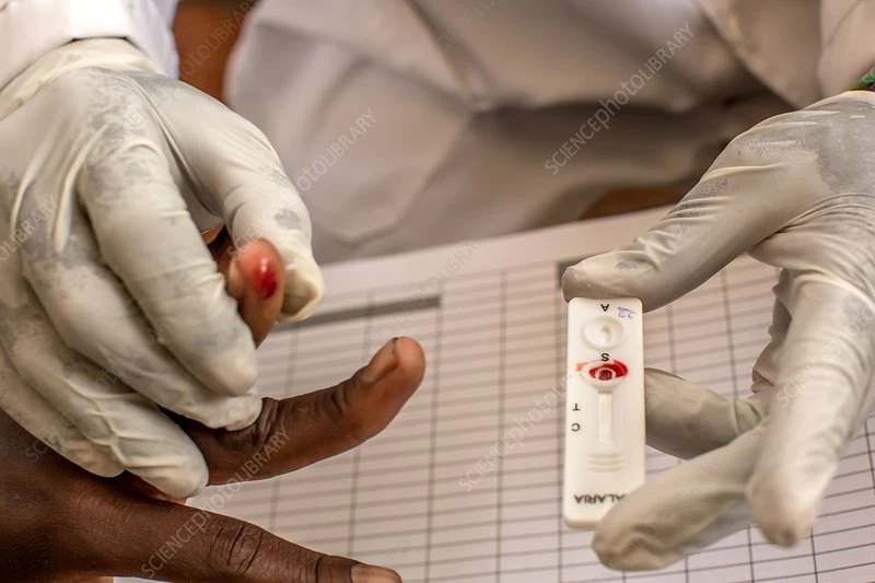 Malaria Rapid Testing Market Insight | Outlook | Growth Analysis Report 2028