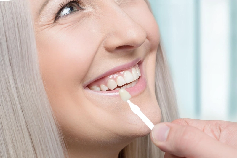 Can Veneers Be Removed?