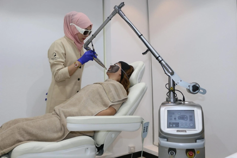 Exploring the Best Carbon Peel Laser Treatments in Dubai