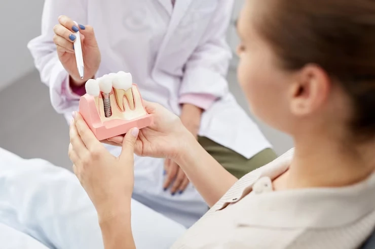 What Are Root Canals And How Does It Help?