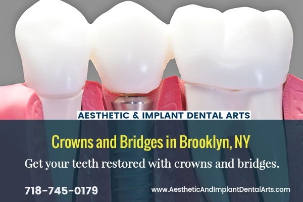 Fix Damaged Teeth with Dental Crowns and Bridges
