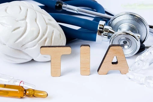 Transient Ischemic Attack (TIA) Market Potential Growth, Share, Demand and Analysis Of Key Players- Research Forecast To 2030