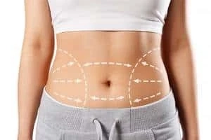 Exploring the World of Tummy Tuck