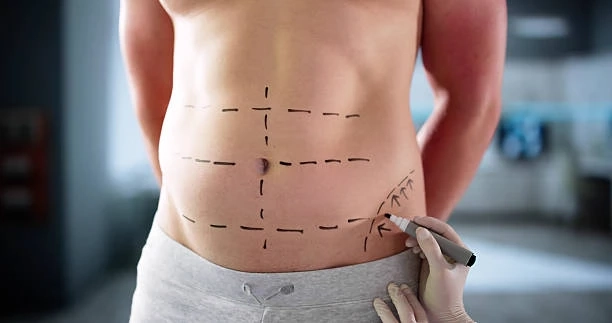 How Fat Melting Injections Transform Your Body Shape Effortlessly