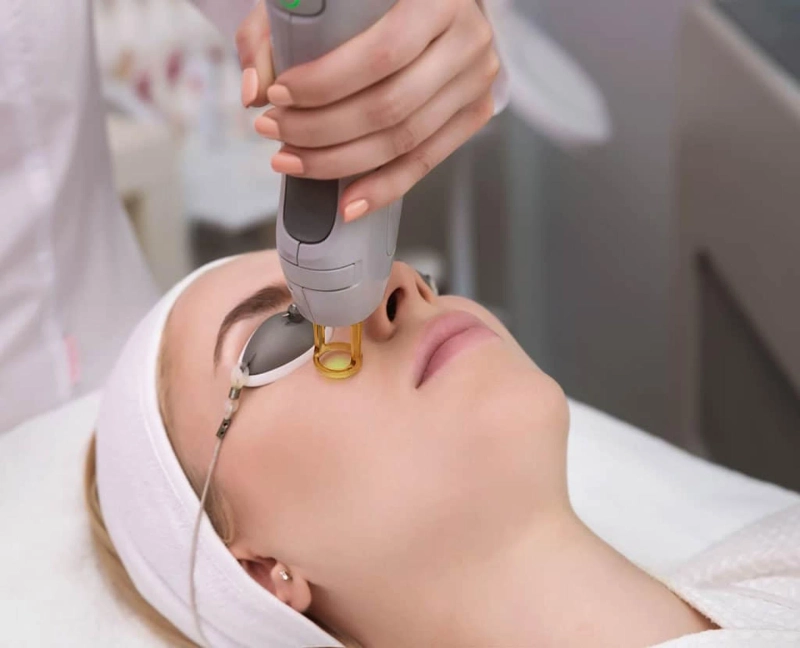 How to Prepare for Your Laser Treatment: A Step-by-Step Guide