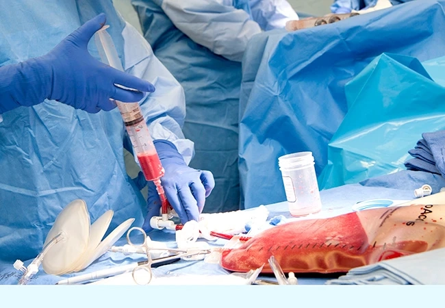 Everything You Need to Know About Arthroscopy