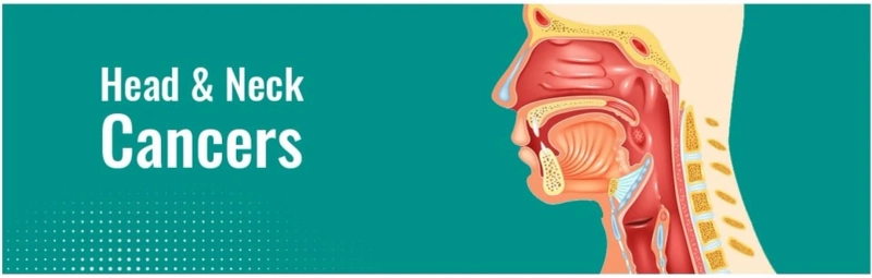 Head and Neck Cancers