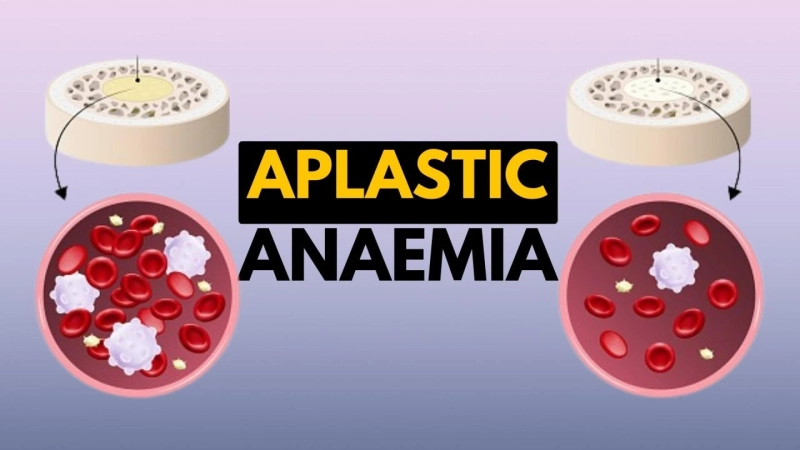 Shaping the Future: Visionary Leaders in Anemia Healthcare