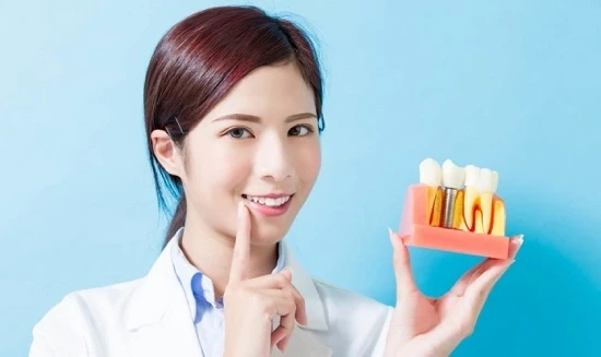 Bảng giá trồng răng Implant - nha khoa Home Dental