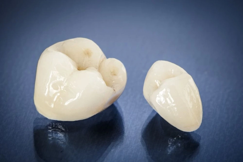 Temporization Material for Dental Market Trends, Share & Forecast Report to 2028