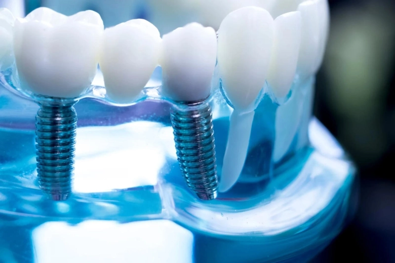 Do you Really Need To Visit Family Dentists